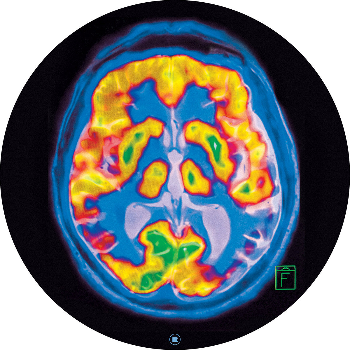 Frankey & Sandrino - Brainscan [Rekids]